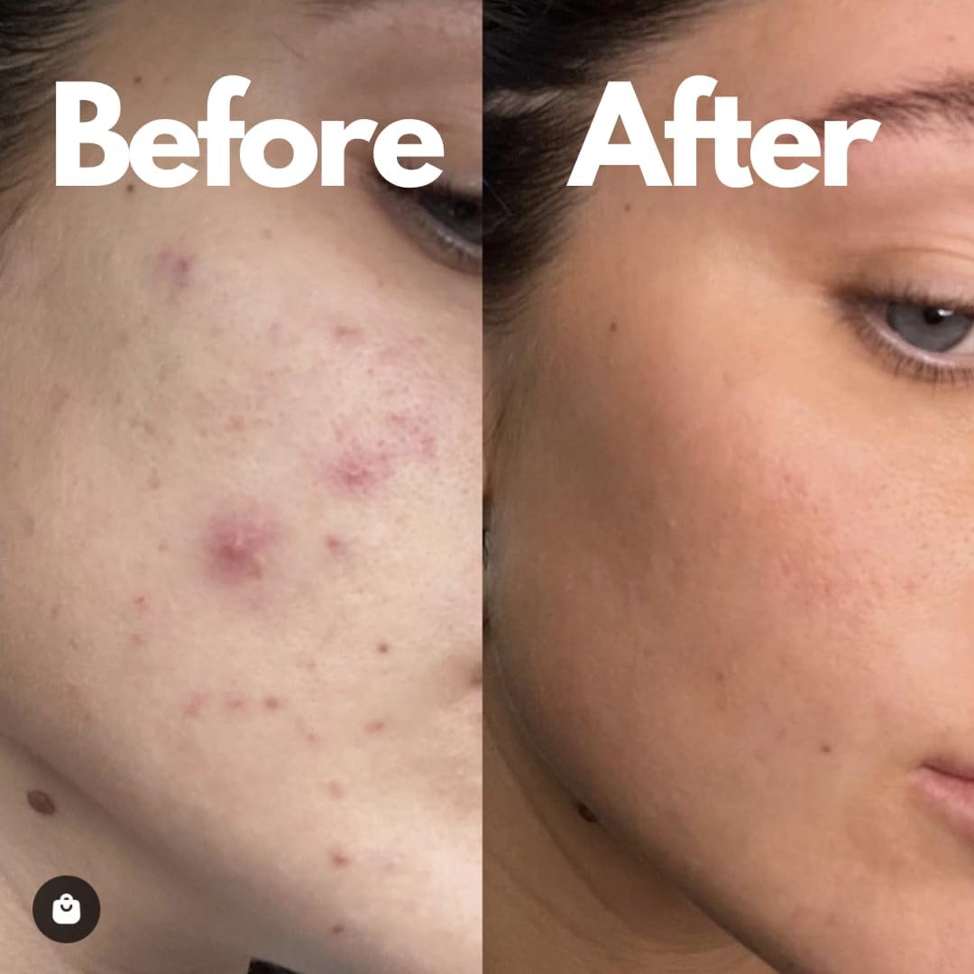 Dr Kinsella CBD Face Cream