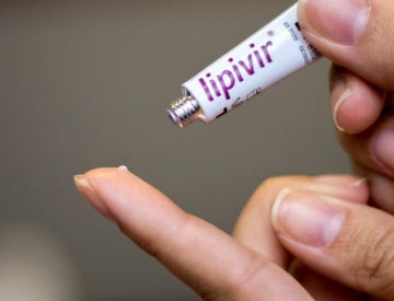 Cold Sore Triggers and How You Can Avoid an Outbreak